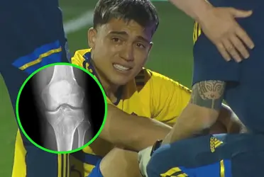 Exequiel ‘el Changuito’ ya sabe cuánto tiempo estará sin jugar.